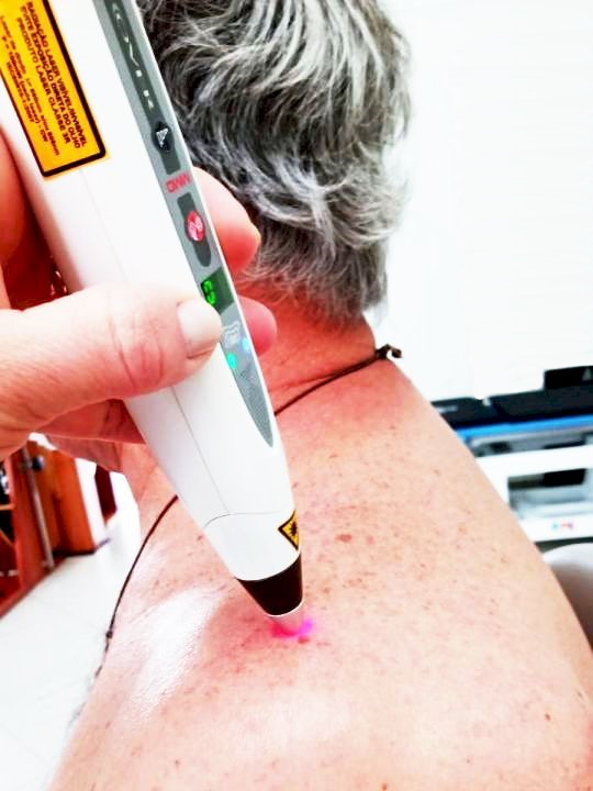 Tratamento com Laser - Fototerapia